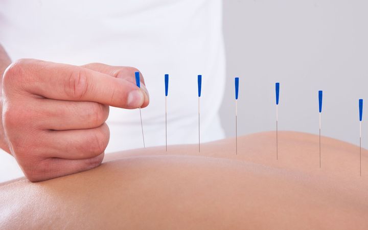 Acupuncturist, acupuncture