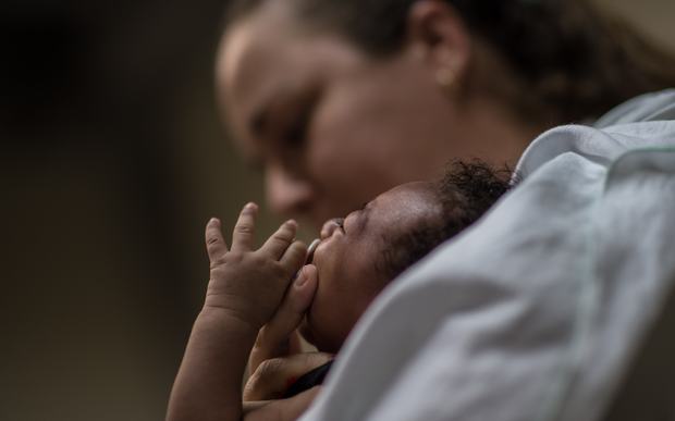A physiotherapist in Brazil holds a baby suffering from microcephalia. 