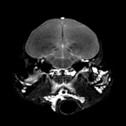 Kiwi MRI