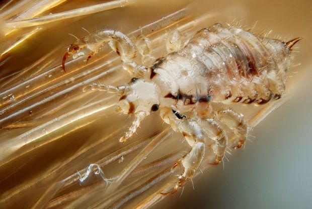 Head louse on hair CC BY SA Gilles San Martin wiki